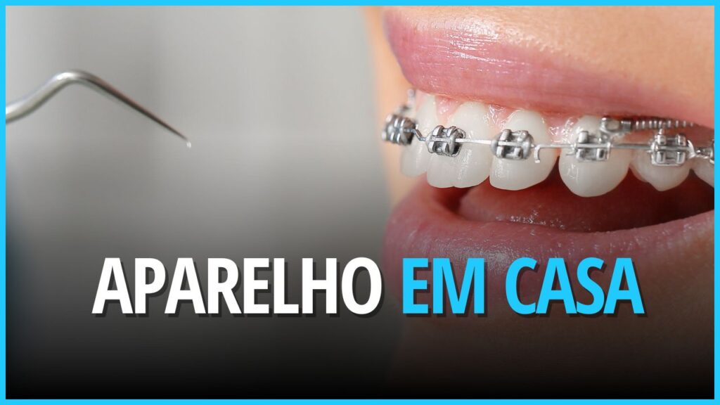 Aparelho dentário em casa