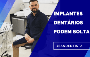 Implantes Dentários são seguros? Será que  valem a pena?