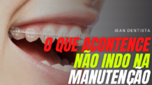 6 motivos para você não faltar a sua manutenção do aparelho