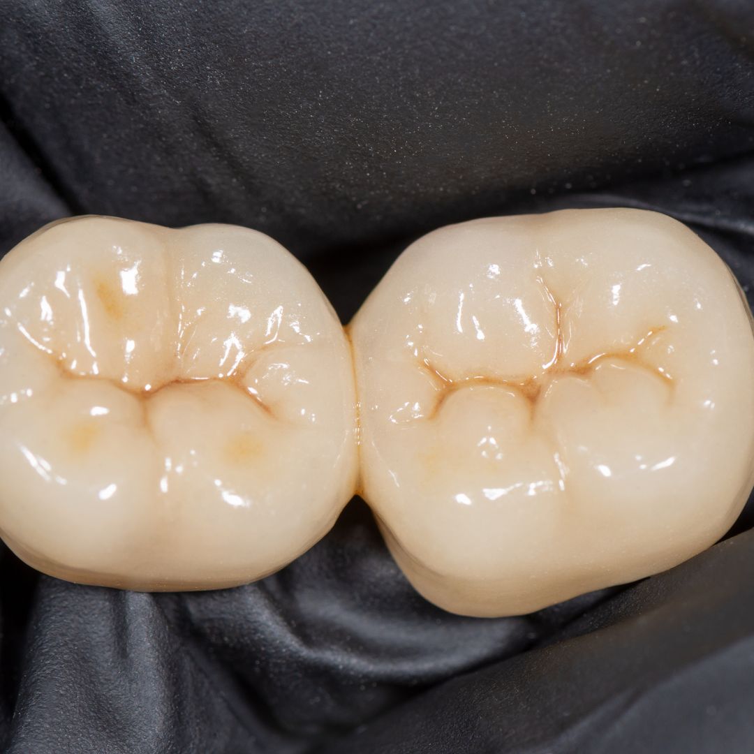 Restauração do Dente: Um Elemento Chave para a Saúde Bucal Integral ...