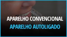 Aparelho ortodôntico convencional é pior que o aparelho autoligado ?