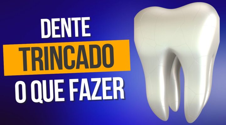 Dente trincado : o que fazer ?