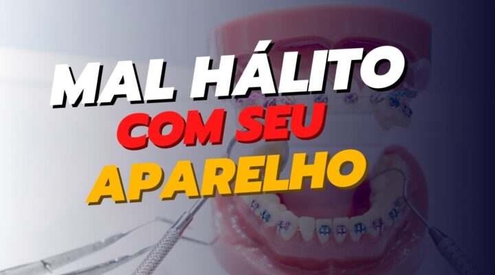 Mau hálito com aparelhos ortodônticos