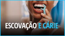 Escovação Dental, Higiene Bucal e Cárie Dental: Entenda a relação