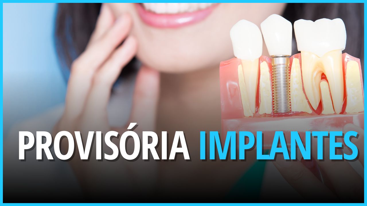Coroa em implante dentário