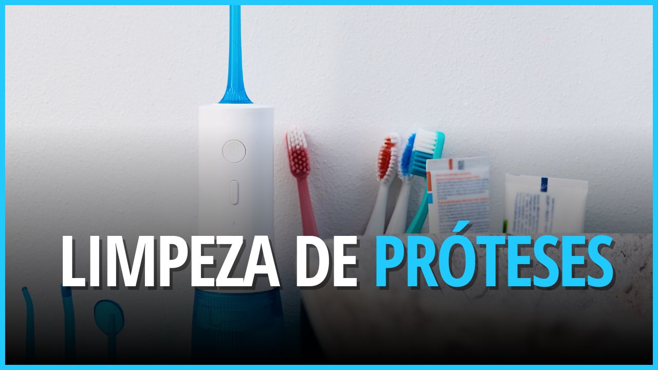 Limpeza de prótese provisória com implantes dentários