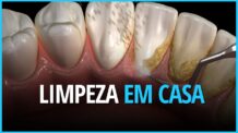 Limpeza dos dentes em casa com irrigadores bucais