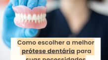 Dentadura Provisória: Com ou sem Implantes