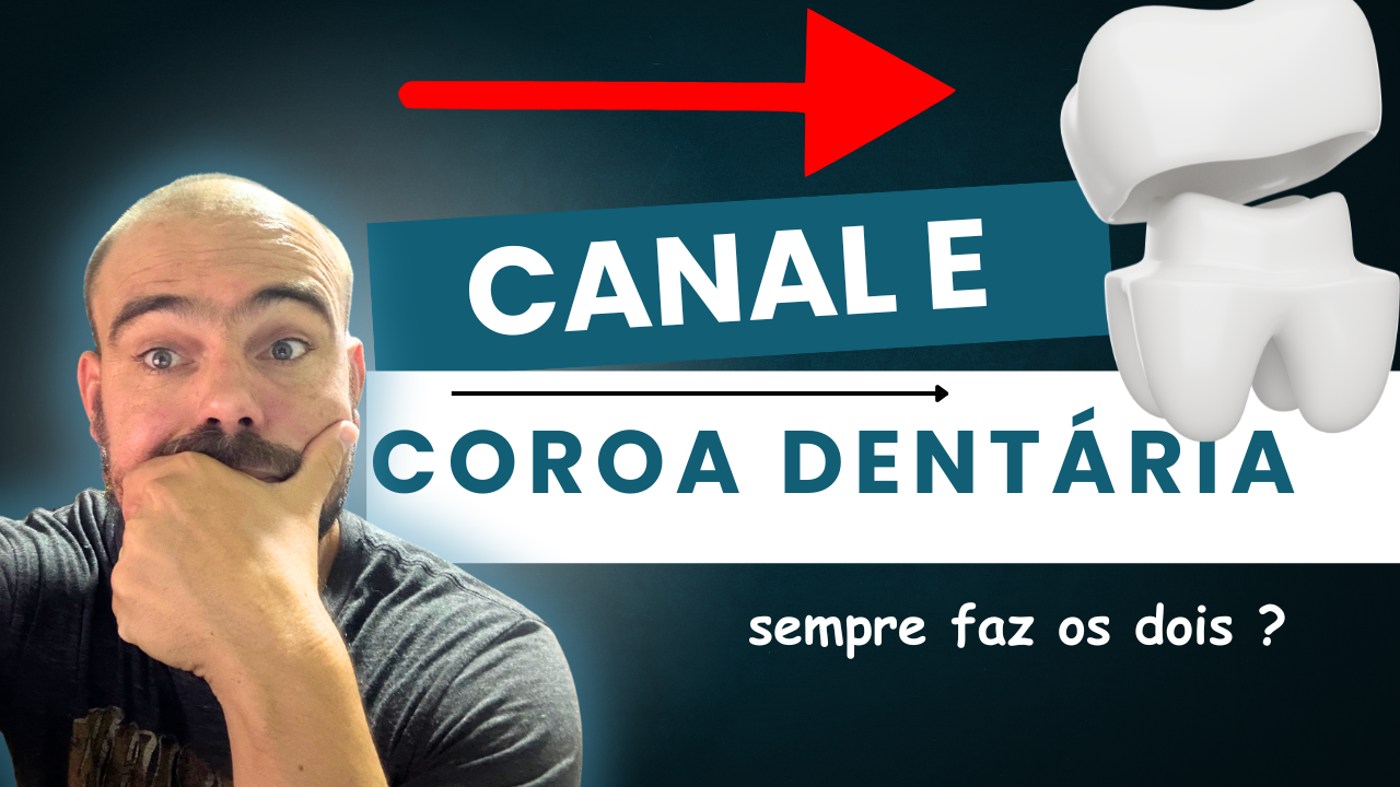 Fiz tratamento de canal preciso coroa dentária ?