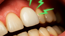 Dor em dente de Porcelana: O Que Pode Ser e O Que Fazer?