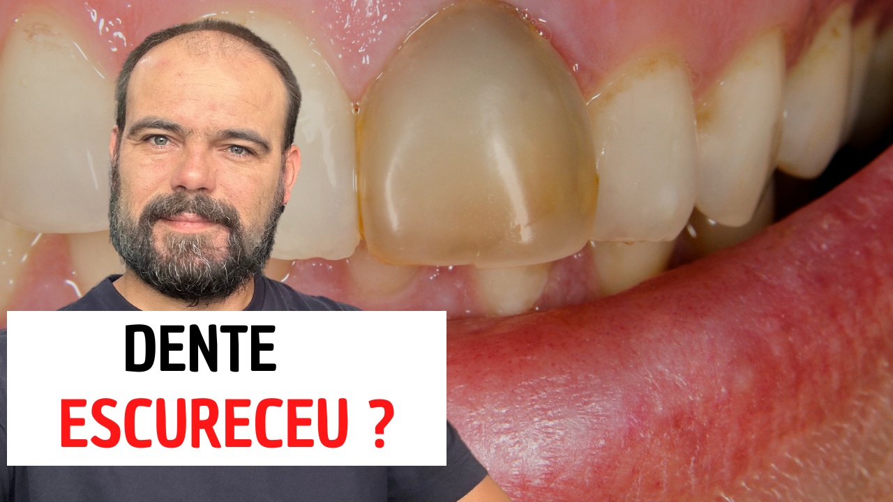 Dente escureceu
