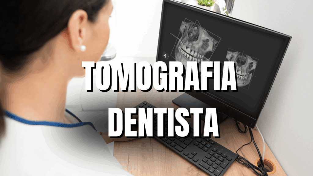 Fazer implantes dentários precisa de tomografia