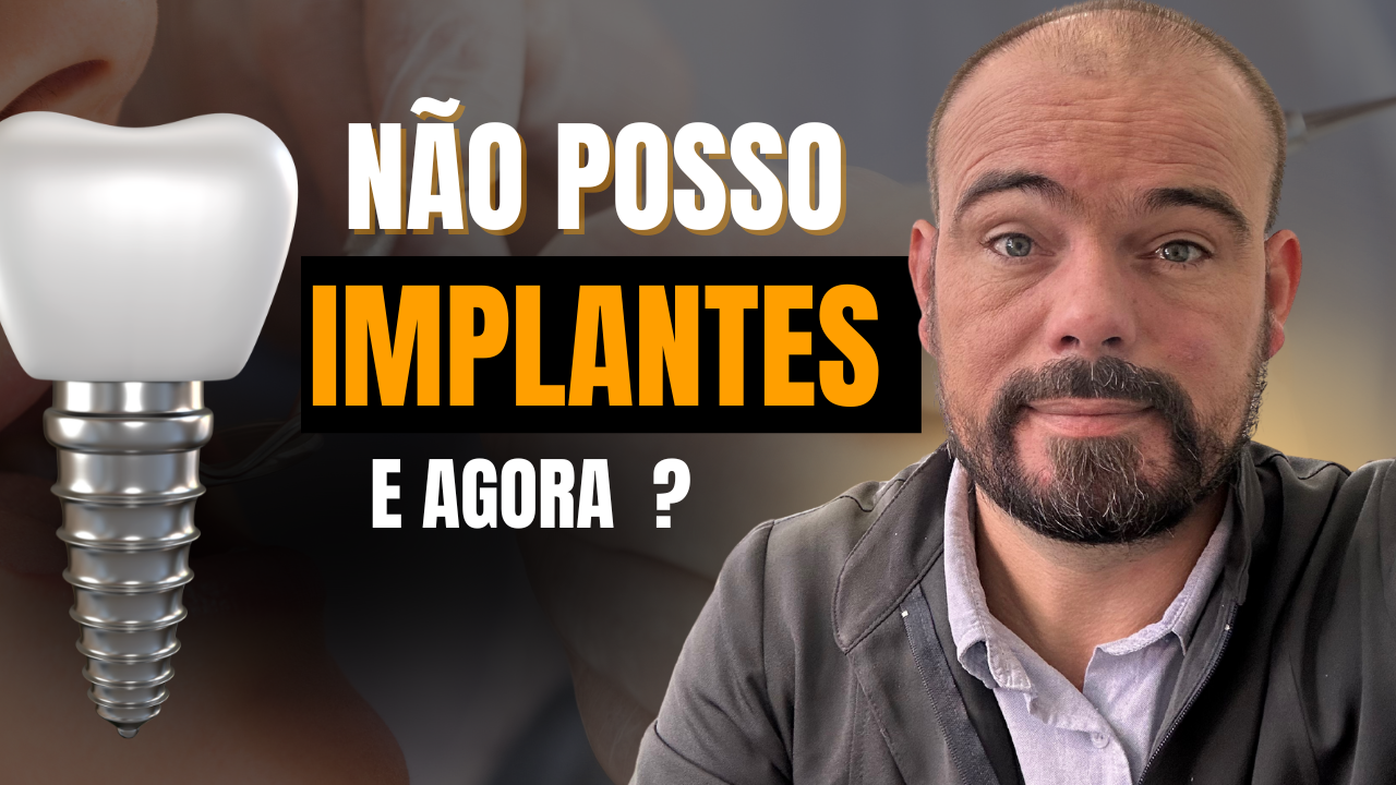 Como Substituir Implantes dentários para quem não pode fazer