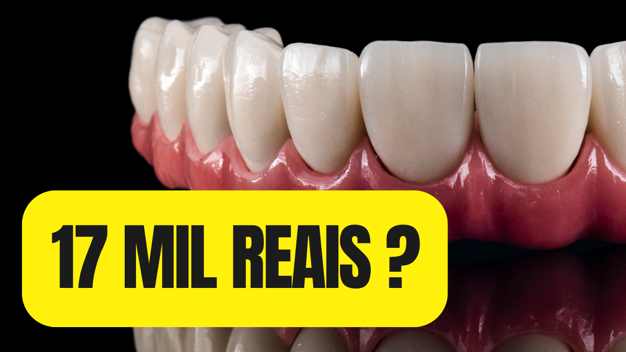 Prótese Dentária Barata: Entenda os Modelos Fixos e Removíveis e as Diferenças de Preço