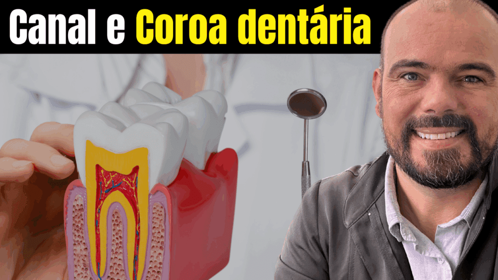 Canal ou Coroa Dentária