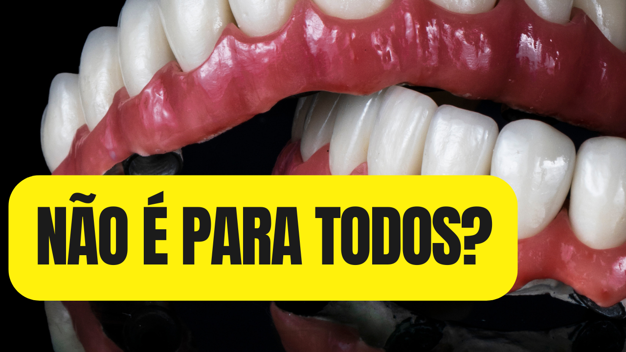 ⚠️ Implantes Dentários Sem Osso: A Verdade Que Poucos Dentistas Têm Coragem de Contar 🦷💀