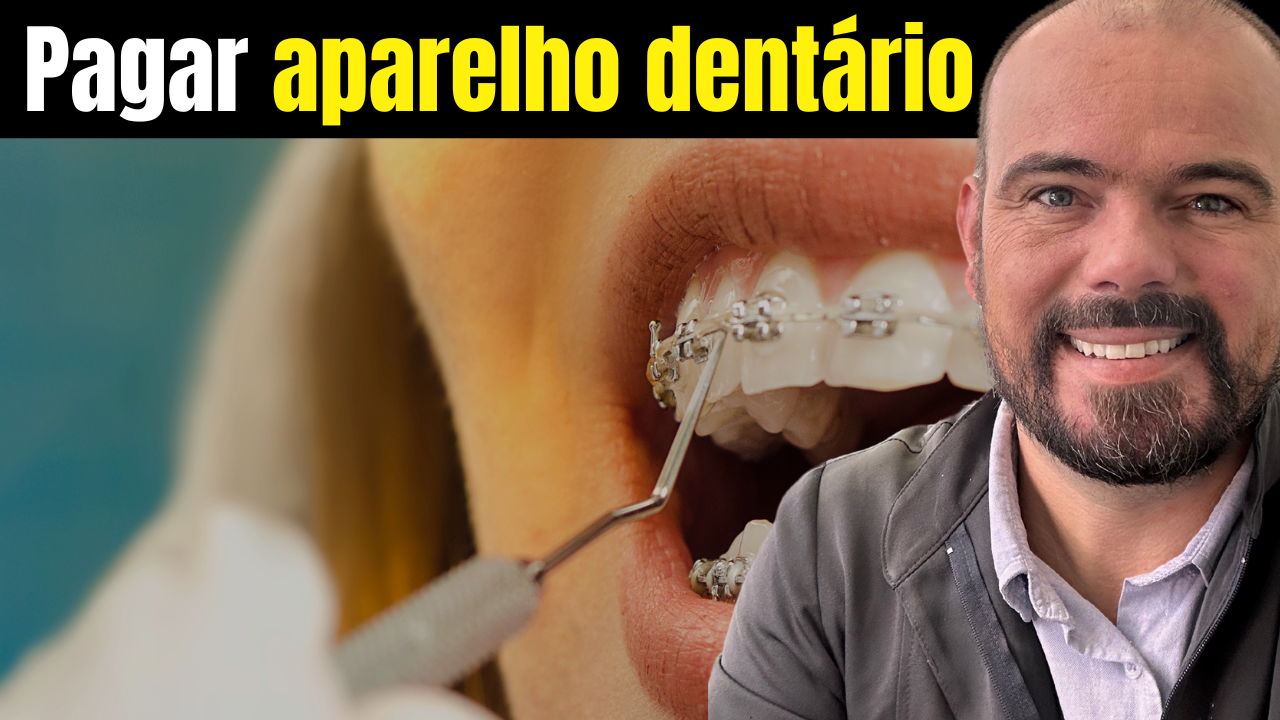 💥 Por Que Pagar Por Aparelho Dentário? A Verdade Que As Clínicas Baratas Não Querem Que Você Saiba 😬