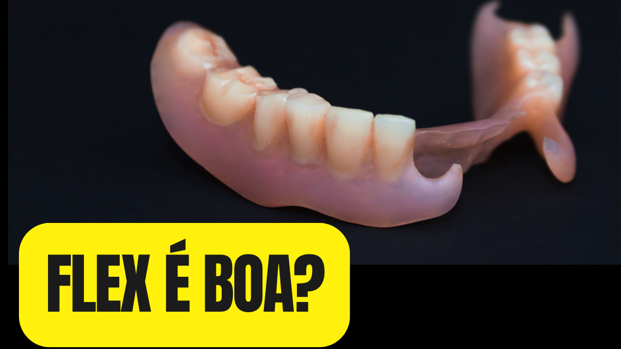 Prótese Flexível Vale a Pena? Vantagens, Desvantagens e Comparação com a de Metal