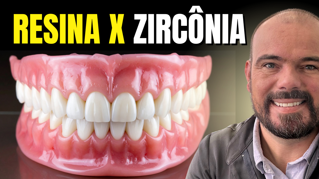 Tipos de Prótese Protocolo: Resina ou Zircônia?