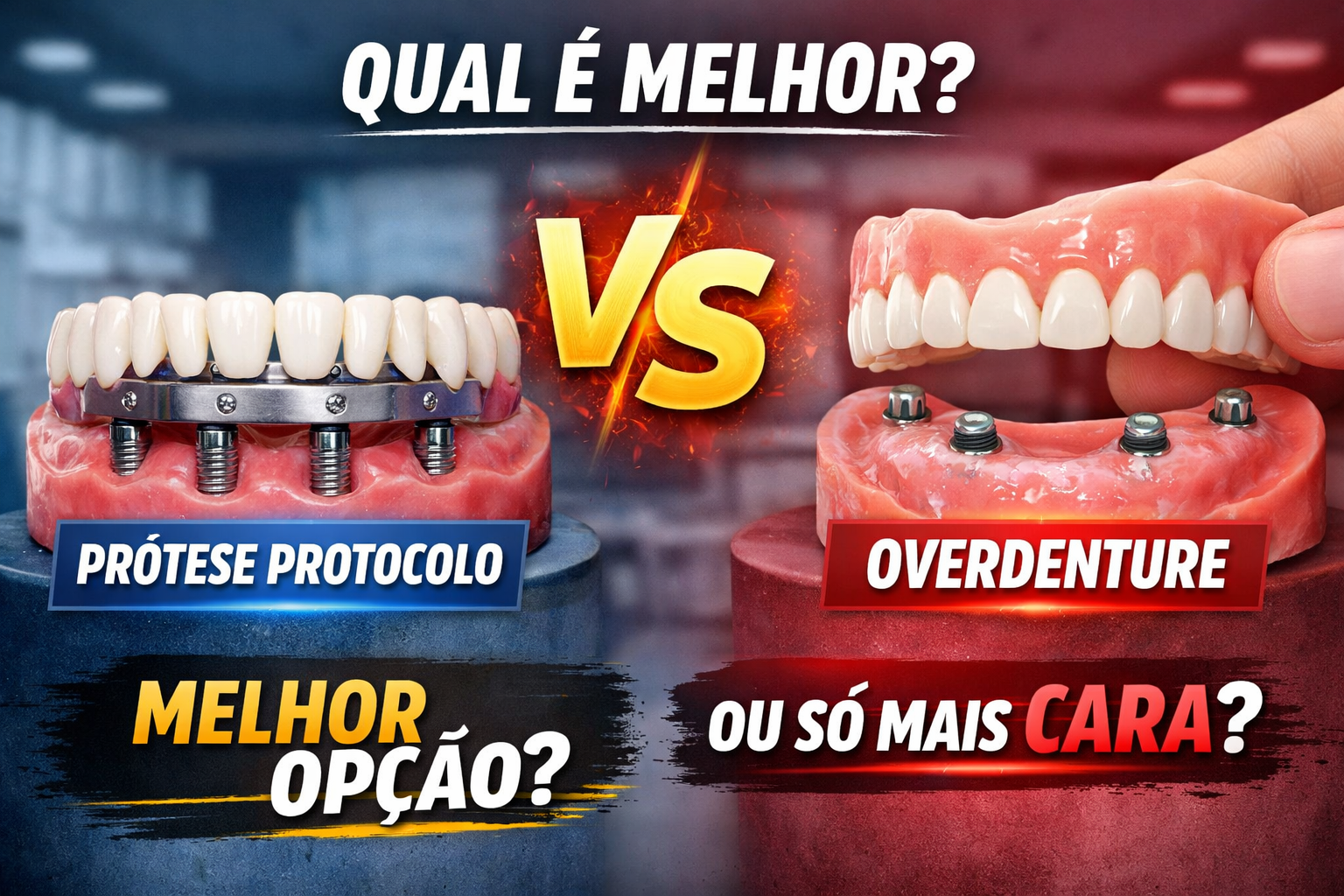 Prótese Protocolo ou Overdenture: qual é melhor?