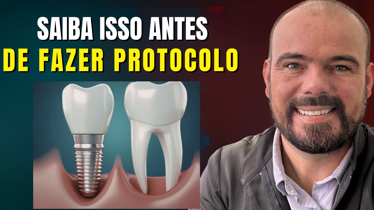 tudo sobre implantes dentários