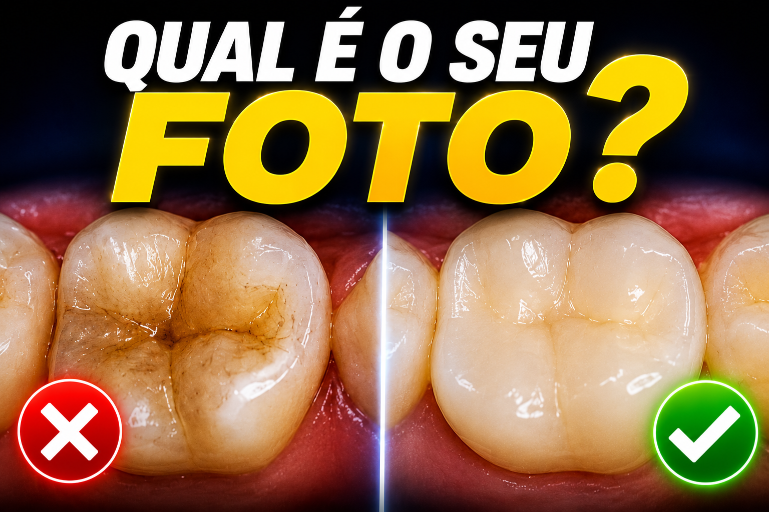 Comprar fotopolimirizador caro vale a pena ?